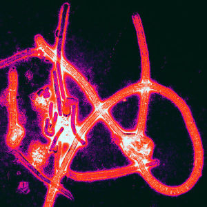 virusul ebola