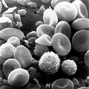 Celulele sangelui vizualizate cu microscopul electronic SEM (public domain)